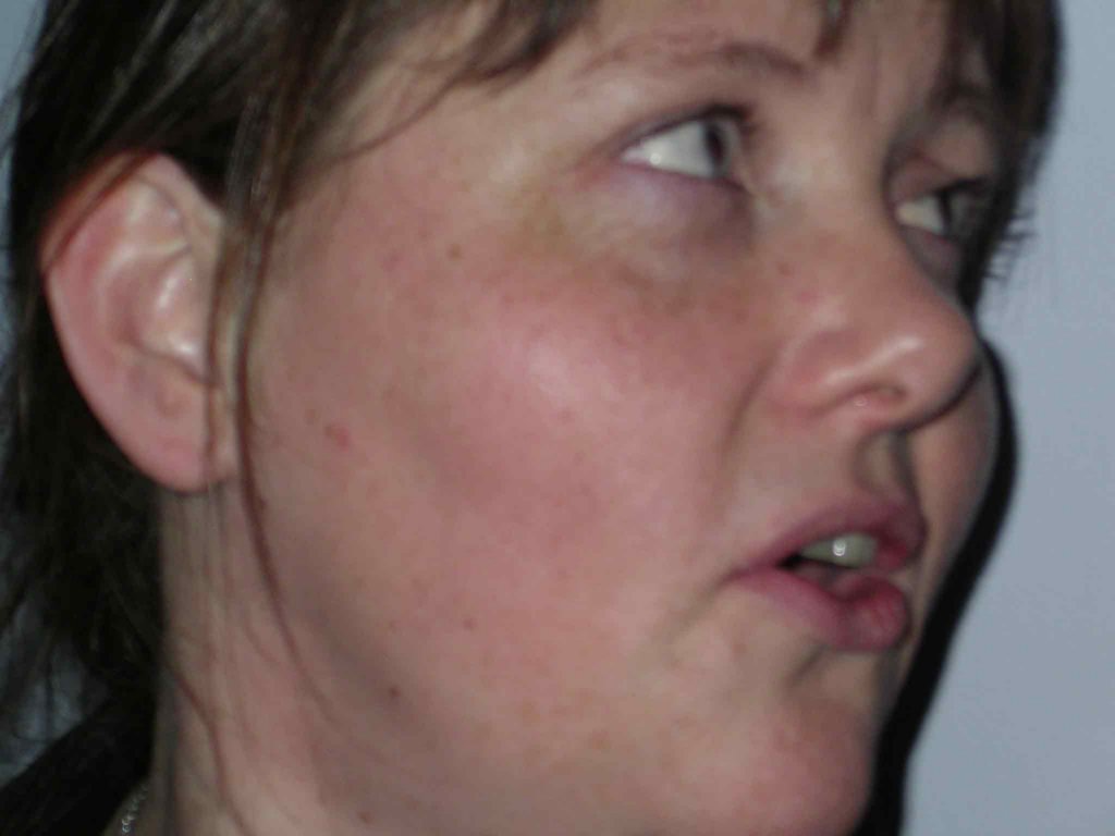 Benkes Party 14
